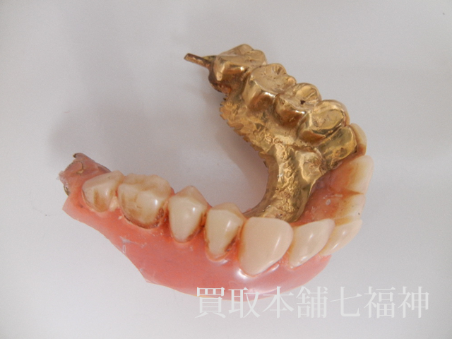 K10 金歯の買取事例