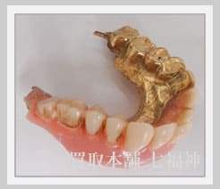 K10 金歯